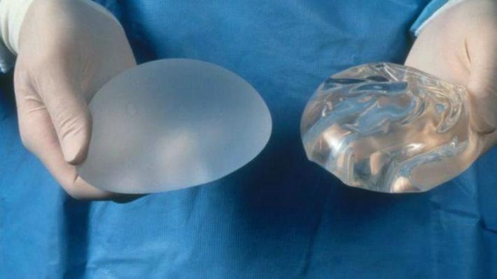 Implantes mamarios aumentan el riesgo de artritis, muerte fetal y cáncer de piel