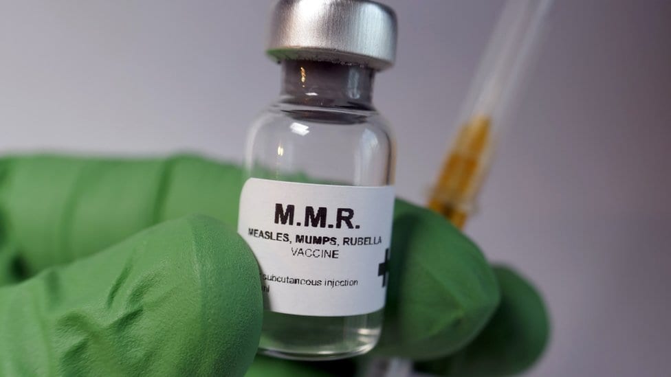 Sarampión: 6 cosas que debes saber sobre la vacuna contra este virus que está en ascenso a nivel mundial –
Noticias BBC