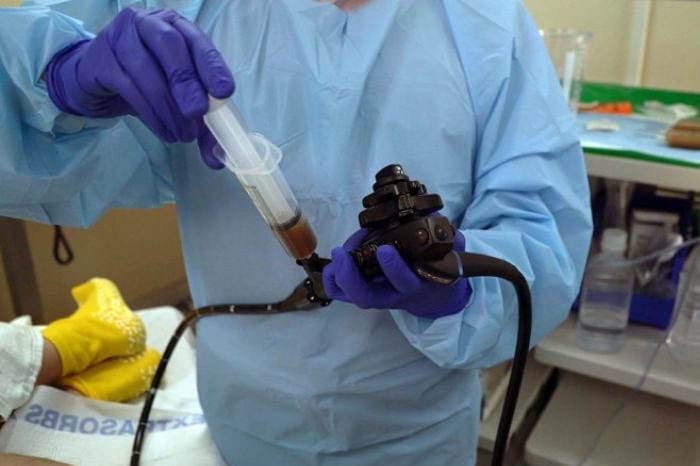 Paciente muere tras recibir un trasplante fecal con bacteria letal : La Voz de Michoacán