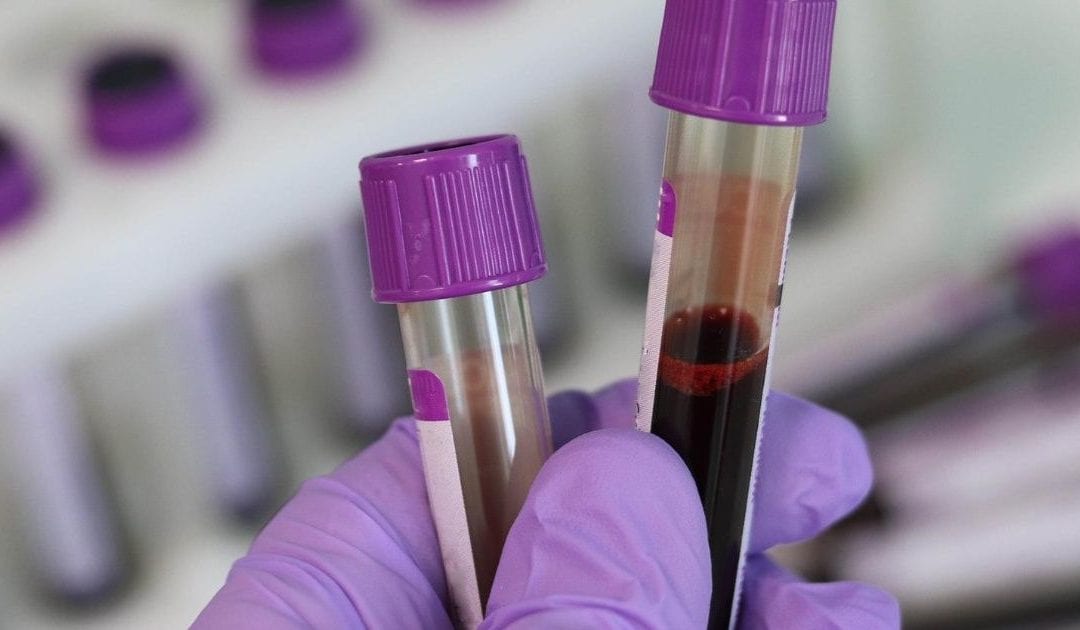 Crean procedimiento que detecta cáncer de ovario y evita cirugía